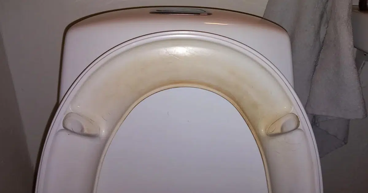How to Remove Toilet Stains and Yellow Rings Fast