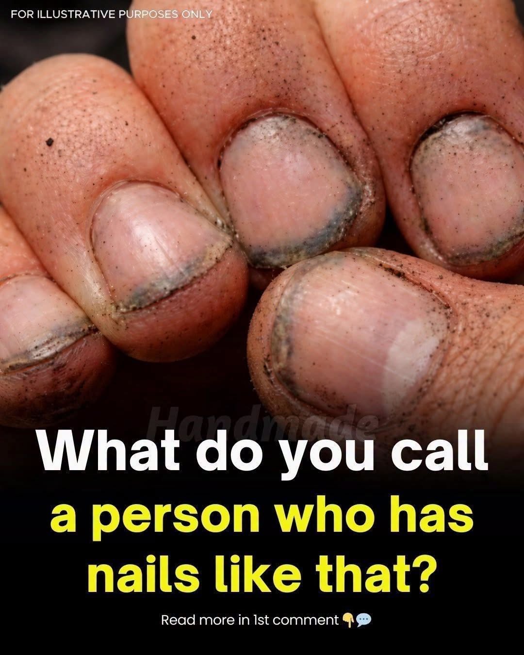 Dirty Fingernails? What They Really Mean